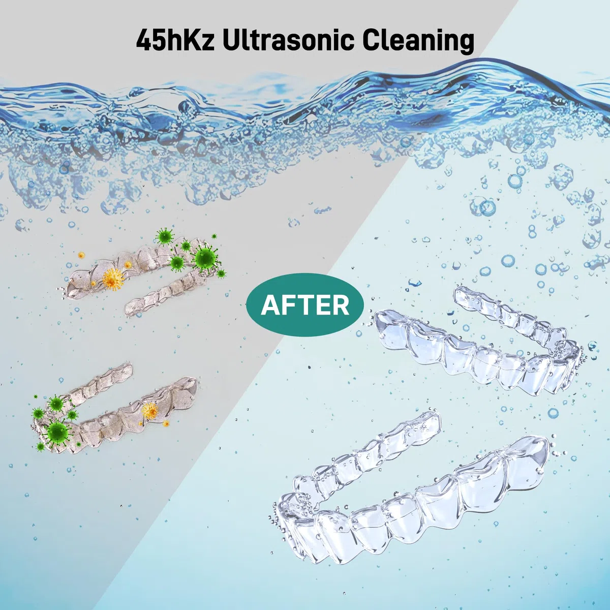 Limpiador ultrasónico de retención, cápsula de limpieza dental con luces U-V, máquina limpiadora de retenedores de 45 kHz para prótesis, cabezales de cepillo de dientes, joyas, alineadores